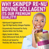 Why SkinPep Re-Nu Bovine Collagen
